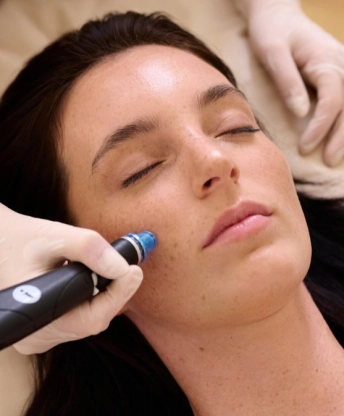 HydraFacial kezelés