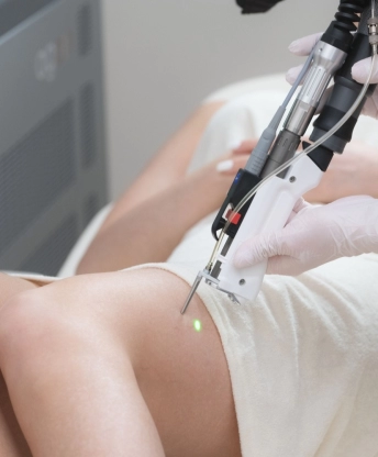 Melyik lézeres technológia a jobb választás számodra?