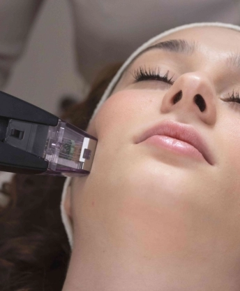 morpheus8 anti-aging bőrfeszesítés