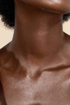 Morpheus és PRP kombinált kezelés