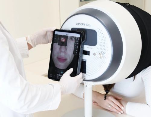 Esztétikai tanácsadás Observ 520X arcdiagnosztikával
