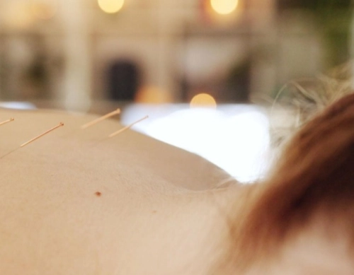 Traditional Chinese Medicine