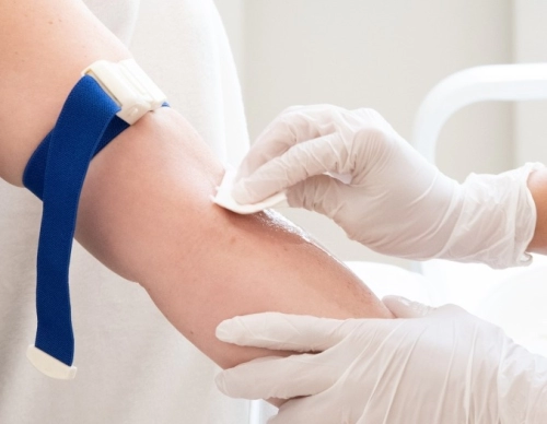 Egész napos vérvétellel kapcsolatos információk