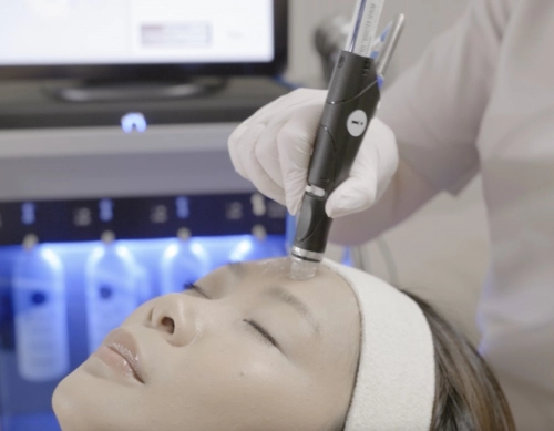 HydraFacial™ arckezelés