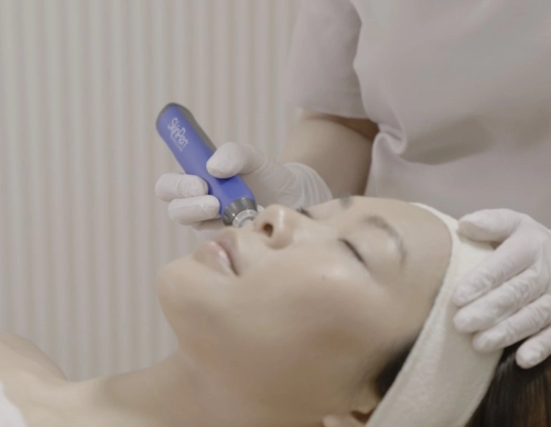 Mikrotűs SkinPen kezelés